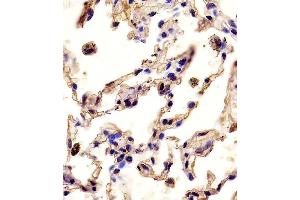 Antibody staining MMP12 in human lung tissue sections by Immunohistochemistry (IHC-P - paraformaldehyde-fixed, paraffin-embedded sections). (MMP12 Antikörper  (C-Term))