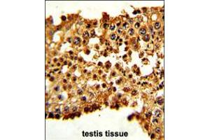 Formalin-fixed and paraffin-embedded human testis tissue with PTTG1 Antibody (N-term), which was peroxidase-conjugated to the secondary antibody, followed by DAB staining. (PTTG1 Antikörper  (N-Term))