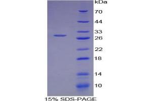SDS-PAGE analysis of Human ATF4 Protein. (ATF4 Protein)