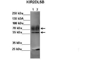 Sample Type: Lane 1: FALG IP'd FLAG-KIR2DL4 transfected NK92 cells Lane 2: FALG IP'd FLAG-KIR2DL5 transfected NK92 cells Primary Antibody Dilution: 1:500Secondary Antibody: Anti-rabbit-HRP Secondary Antibody Dilution: 1:00,000 Color/Signal Descriptions: KIR2DL5B  Gene Name: Kerry S. (KIR2DL5B Antikörper  (C-Term))