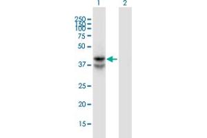 Western Blot analysis of LDHAL6B expression in transfected 293T cell line by LDHAL6B monoclonal antibody (M01), clone 1A3. (LDHAL6B Antikörper  (AA 282-381))