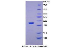 SDS-PAGE analysis of Mouse PHLDA2 Protein. (PHLDA2 Protein)