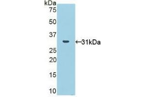 Detection of Recombinant NOX1, Human using Polyclonal Antibody to Nicotinamide Adenine Dinucleotide Phosphate Oxidase 1 (NOX1) (NOX1 Antikörper  (AA 235-488))