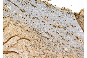 ABIN6263548 and ABIN6277572 at 1/100 staining Rat brain tissue by IHC-P. (NDC80 Antikörper  (C-Term))