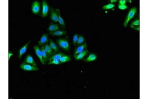 Immunofluorescent analysis of HepG2 cells using ABIN7175662 at dilution of 1:100 and Alexa Fluor 488-congugated AffiniPure Goat Anti-Rabbit IgG(H+L) (SORCS2 Antikörper  (AA 712-786))