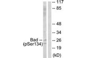 Western blot analysis of extracts from mouse liver, using BAD (Phospho-Ser134) Antibody. (BAD Antikörper  (pSer134))
