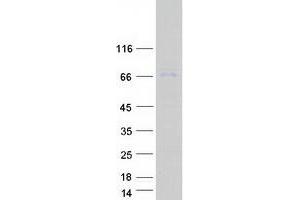 Validation with Western Blot (CPT2 Protein (Myc-DYKDDDDK Tag))