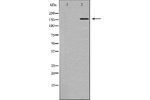 Western blot analysis of DNA Polymerase α expression in 293 cells,The lane on the left is treated with the antigen-specific peptide. (POLA1 Antikörper  (N-Term))