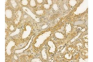 ABIN6264846 and ABIN6273312 at 1/100 staining human normal kidney tissue by IHC-P. (RPS14 Antikörper  (Internal Region))