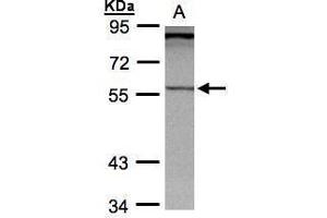 WB Image Sample (30μg whole cell lysate) A: Hep G2 , 7. (PCCB Antikörper  (Center))