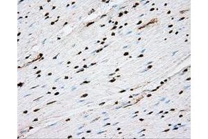 Immunohistochemical staining of paraffin-embedded liver tissue using anti-ACSBG1 mouse monoclonal antibody. (ACSBG1 Antikörper)