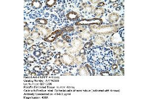 Rabbit Anti-HNRPF Antibody  Paraffin Embedded Tissue: Human Kidney Cellular Data: Epithelial cells of renal tubule Antibody Concentration: 4. (HNRNPF Antikörper  (C-Term))