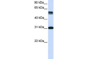 WB Suggested Anti-TRIM31 Antibody Titration: 0. (TRIM31 Antikörper  (Middle Region))