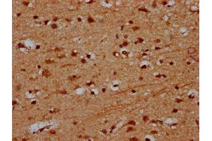 IHC image of ABIN7164105 diluted at 1:600 and staining in paraffin-embedded human brain tissue performed on a Leica BondTM system. (PRDM11 Antikörper  (AA 63-215))
