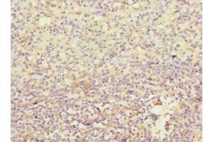 Immunohistochemistry of paraffin-embedded human spleen tissue using ABIN7156851 at dilution of 1:100 (IL21 Receptor Antikörper  (AA 20-240))