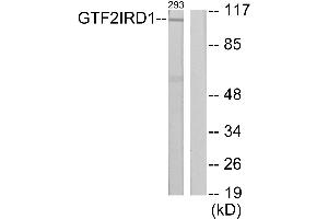 Western blot analysis of extracts from 293 cells, using GTF2IRD1 antibody. (GTF2IRD1 Antikörper)
