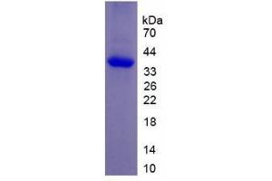 SDS-PAGE analysis of Rat NPY Protein. (Neuropeptide Y (NPY) Peptid)