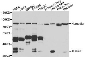 Western blot analysis of extracts of various cell lines, using TP53I3 antibody (ABIN5974745) at 1/1000 dilution. (TP53I3 Antikörper)
