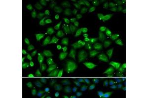 Immunofluorescence analysis of HeLa cells using NHLRC1 Polyclonal Antibody (NHLRC1 Antikörper)