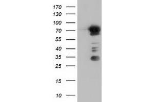 Western Blotting (WB) image for anti-rho GTPase Activating Protein 25 (ARHGAP25) antibody (ABIN1496705)