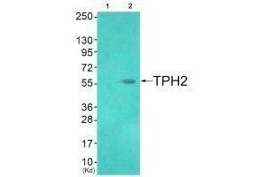 Western blot analysis of extracts from HuvEc cells (Lane 2), using TPH2 (Ab-19) antiobdy. (Tryptophan Hydroxylase 2 Antikörper  (Ser19))