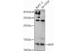 Western Blotting (WB) image for anti-Natriuretic Peptides B (NPPB) (AA 1-134) antibody (ABIN3023136)