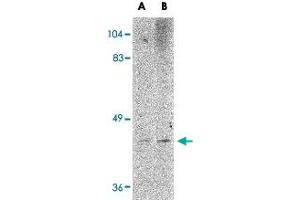 Western blot analysis of LASS6 in rat brain tissue lysate with LASS6 polyclonal antibody  at (A) 1 and (B) 2 ug/mL .