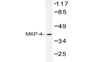 Western blot (WB) analysis of MKP-4 antibody in extracts from HeLa cells. (DUSP9 Antikörper)