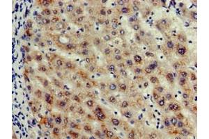Immunohistochemistry of paraffin-embedded human liver tissue using ABIN7156146 at dilution of 1:100 (Caspase 12 Antikörper  (AA 61-282))