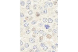 Immunohistochemistry (IHC) image for anti-Geminin, DNA Replication Inhibitor (GMNN) (C-Term) antibody (ABIN7453481)