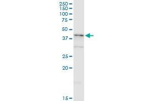 NDRG2 monoclonal antibody (M03), clone 6A5. (NDRG2 Antikörper  (AA 1-96))