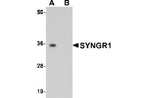 Western Blotting (WB) image for anti-Synaptogyrin 1 (SYNGR1) (Middle Region) antibody (ABIN1031113) (Synaptogyrin 1 Antikörper  (Middle Region))