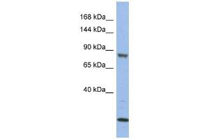 MAP3K11 antibody used at 1 ug/ml to detect target protein. (MAP3K11 Antikörper  (Middle Region))