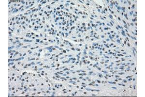 Image no. 2 for anti-Synovial Sarcoma, X Breakpoint 2 (SSX2) antibody (ABIN1501162) (SSX2 Antikörper)