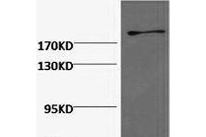 Western Blot analysis of Hela cells using FN1 Monoclonal Antibody at dilution of 1:2000.
