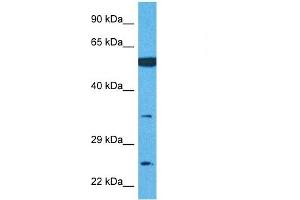 Host:  Rabbit  Target Name:  TMEM158  Sample Tissue:  Human U937 Whole Cell  Antibody Dilution:  1ug/ml (TMEM158 Antikörper  (Middle Region))