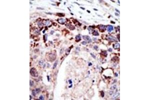 Image no. 2 for anti-Ataxin 3 (ATXN3) (N-Term) antibody (ABIN357621) (Ataxin 3 Antikörper  (N-Term))