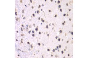 Immunohistochemistry of paraffin-embedded mouse brain using PRMT5 antibody (ABIN5970714) at dilution of 1/100 (40x lens).