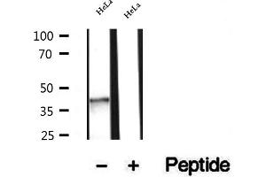 Western blot analysis of extracts of HeLa cells, using NSDHL antibody.