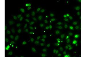 Immunofluorescence analysis of MCF7 cell using NGFRAP1 antibody. (Nerve Growth Factor Receptor (TNFRSF16) Associated Protein 1 (NGFRAP1) Antikörper)