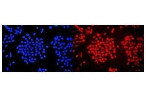 IF analysis of WAC using anti-WAC antibody (ABIN7601789). (WAC Antikörper  (AA 459-647))
