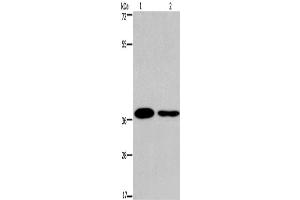 Western Blotting (WB) image for anti-SNAIL (SNAI1) antibody (ABIN2428726) (SNAIL Antikörper)