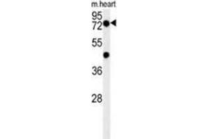 Western Blotting (WB) image for anti-Putative Homeodomain Transcription Factor 2 (PHTF2) (AA 388-418), (Middle Region) antibody (ABIN954130)