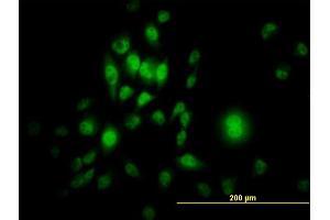 Immunofluorescence of monoclonal antibody to SP1 on HeLa cell. (SP1 Antikörper  (AA 89-198))