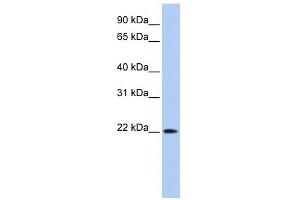 WB Suggested Anti-DNASE2B Antibody Titration:  0.