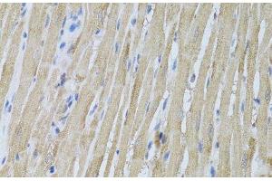 Immunohistochemistry of paraffin-embedded Rat heart using P2RY2 Polyclonal Antibody at dilution of 1:100 (40x lens).