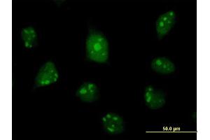 Immunofluorescence of purified MaxPab antibody to C1D on HeLa cell.