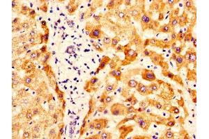 IHC image of ABIN7162288 diluted at 1:400 and staining in paraffin-embedded human liver tissue performed on a Leica BondTM system. (OTC Antikörper  (AA 33-354))