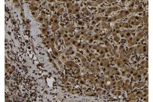 ABIN6276971 at 1/100 staining Human liver tissue by IHC-P. (FE65 Antikörper  (C-Term))