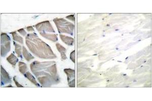 Immunohistochemistry analysis of paraffin-embedded human skeletal muscle tissue, using Actin-pan Antibody. (Actin Antikörper  (AA 326-375))